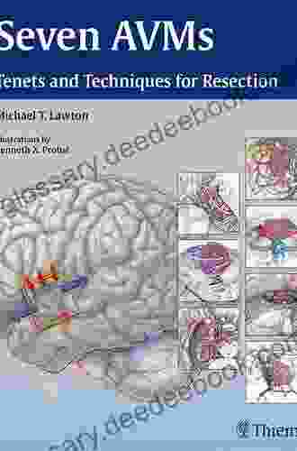 Seven AVMs: Tenets and Techniques for Resection